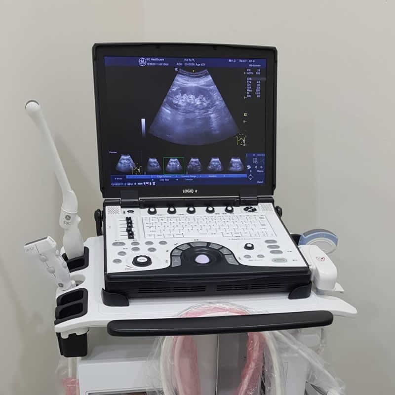 超音波掃瞄儀